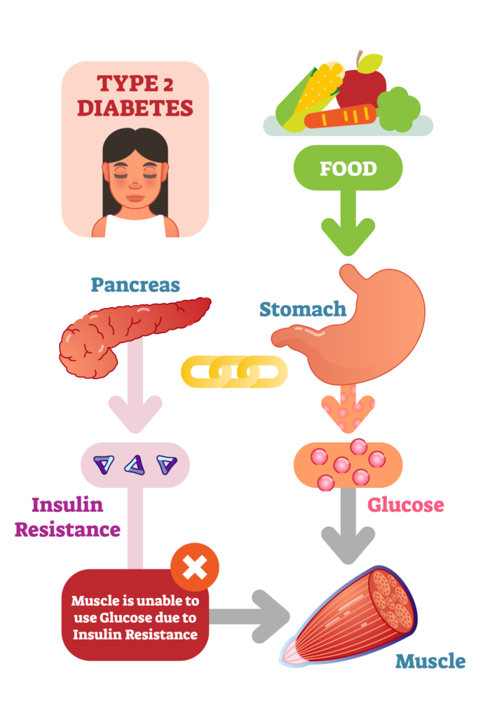 Diabetes Basics - Hunter Diabetes Centre